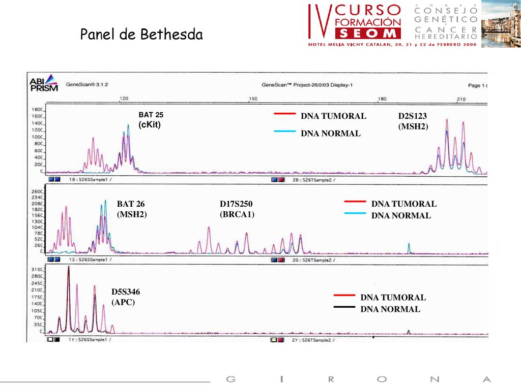 Panel de Bethesda DNA NORMAL DNA TUMORAL (cKit) D2S123 (MSH2) BAT 26