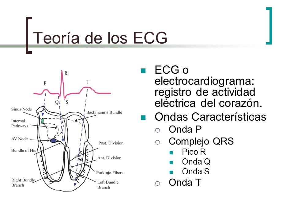 Teoría de los ECG ECG o electrocardiograma: registro de actividad eléctrica del corazón. Ondas Características.