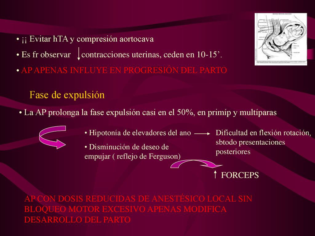 Fase de expulsión ¡¡ Evitar hTA y compresión aortocava