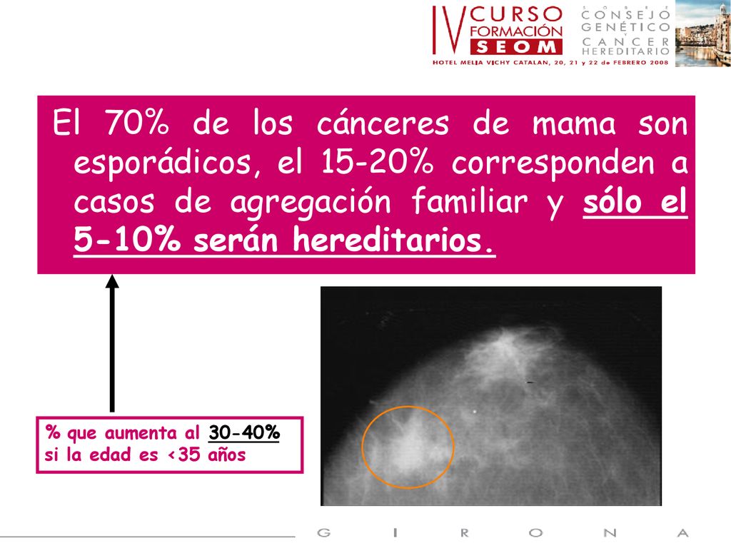 El 70% de los cánceres de mama son esporádicos, el 15-20% corresponden a casos de agregación familiar y sólo el 5-10% serán hereditarios.
