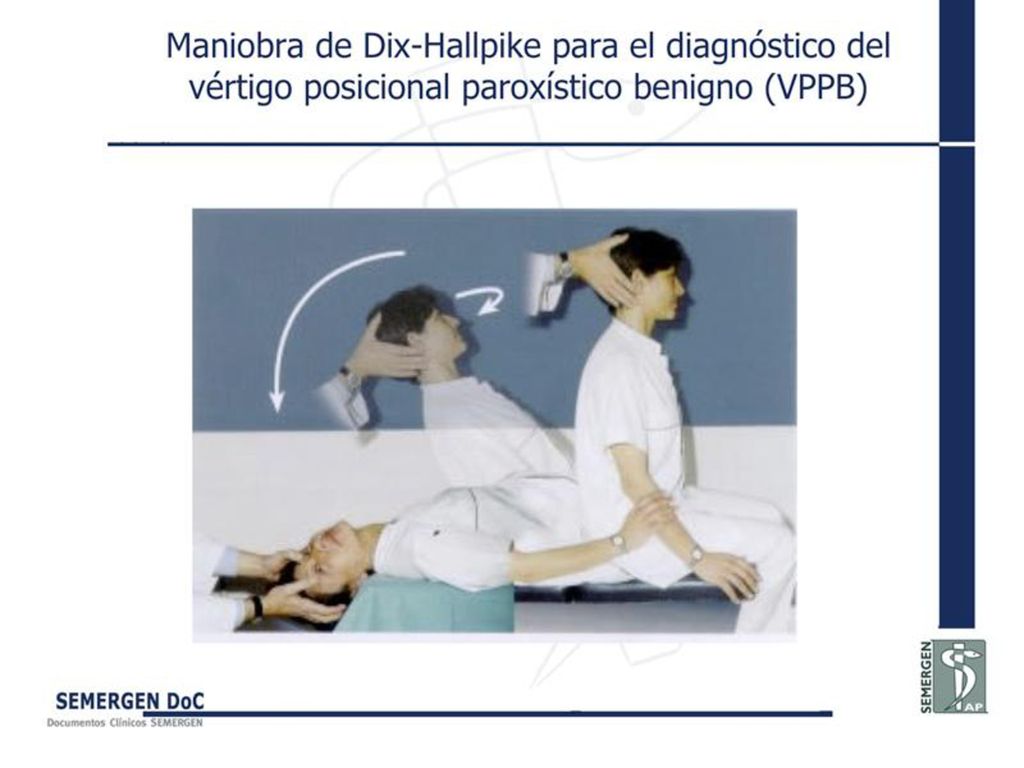 Maniobra de Dix-Hallpike para el diagnóstico del vértigo posicional paroxístico benigno (VPPB)