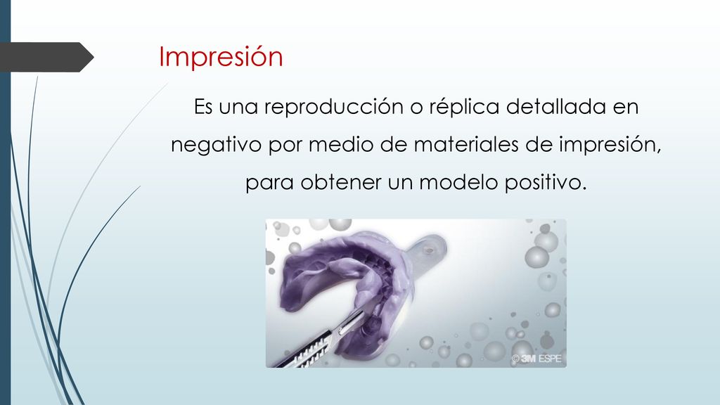 Impresión Es una reproducción o réplica detallada en negativo por medio de materiales de impresión, para obtener un modelo positivo.