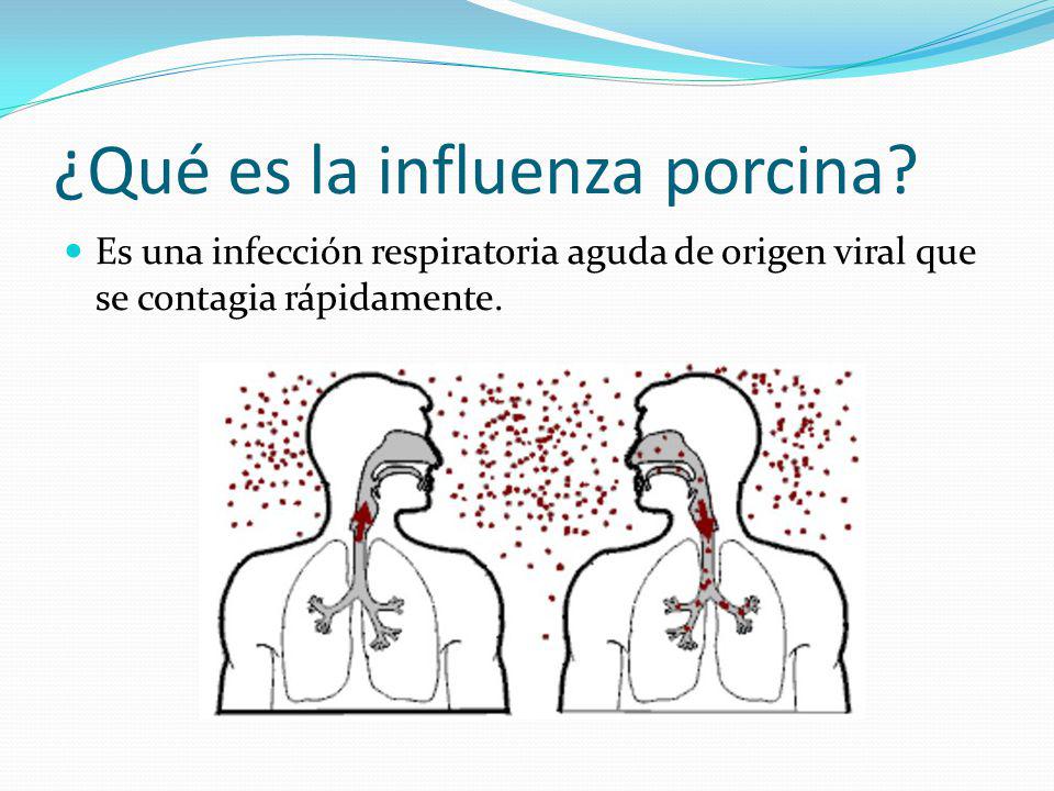 ¿Qué es la influenza porcina