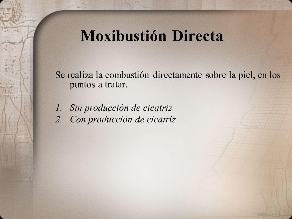 Moxibustión Directa Se realiza la combustión directamente sobre la piel, en los puntos a tratar. Sin producción de cicatriz.