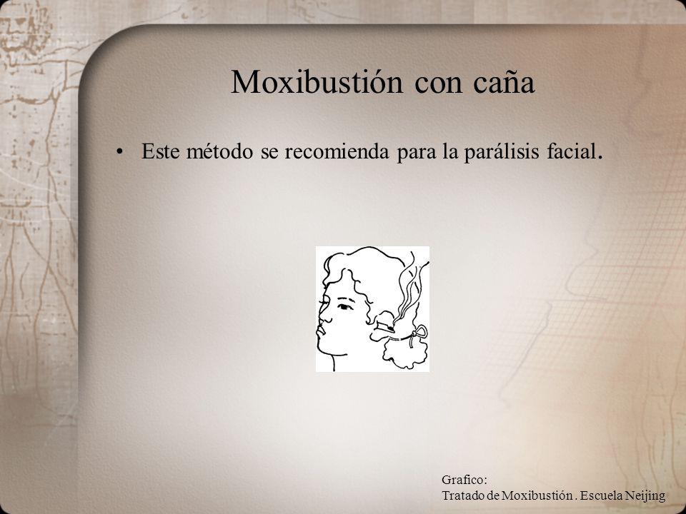 Moxibustión con caña Este método se recomienda para la parálisis facial.