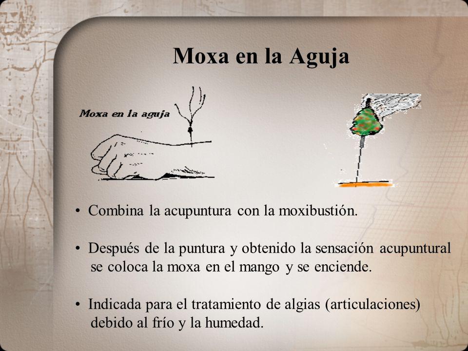 Moxa en la Aguja Combina la acupuntura con la moxibustión.