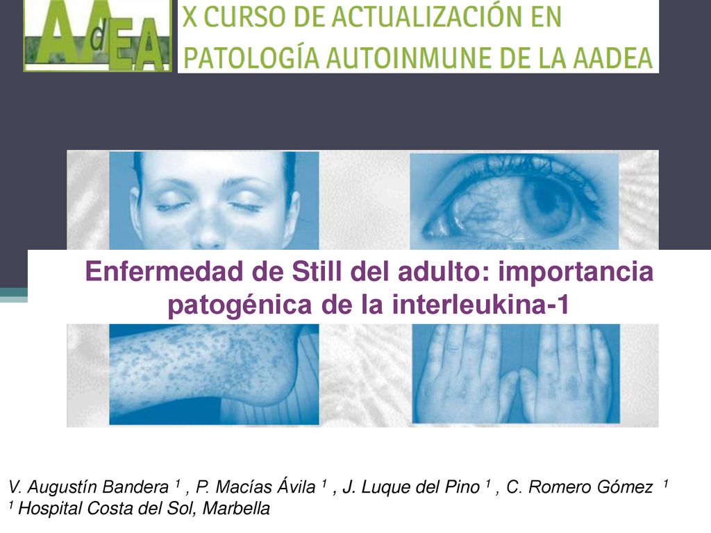 Enfermedad de Still del adulto: importancia patogénica de la interleukina-1