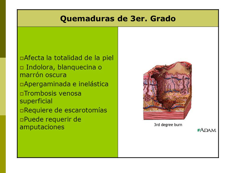 Quemaduras de 3er. Grado Afecta la totalidad de la piel