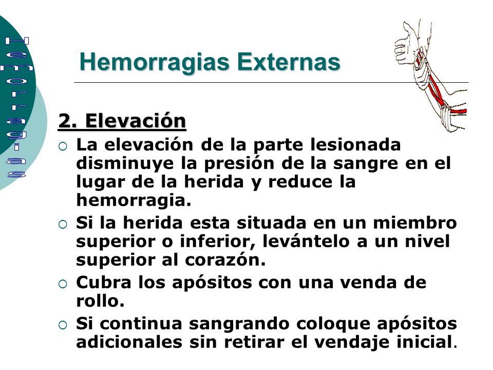 Hemorragias Externas Hemorragias 2. Elevación