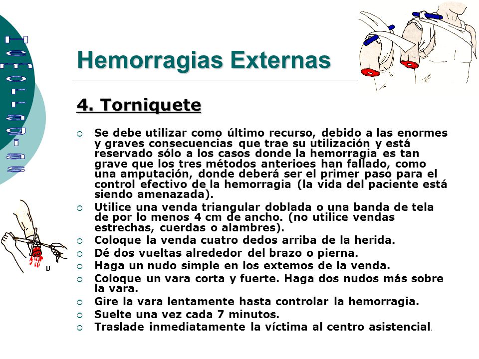 Hemorragias Externas Hemorragias 4. Torniquete