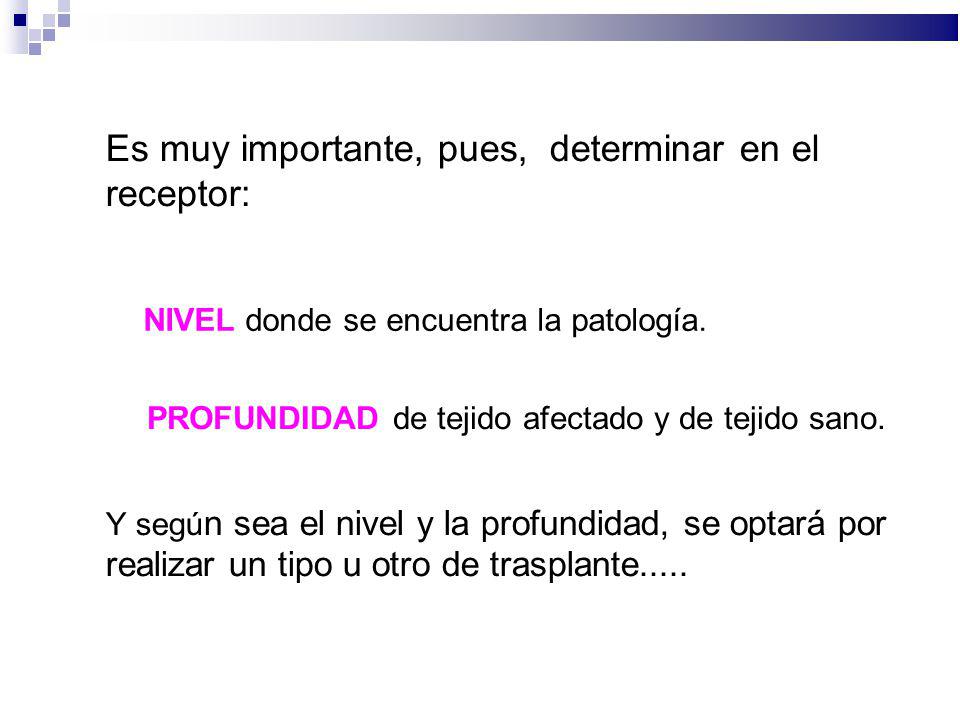 Es muy importante, pues, determinar en el receptor: