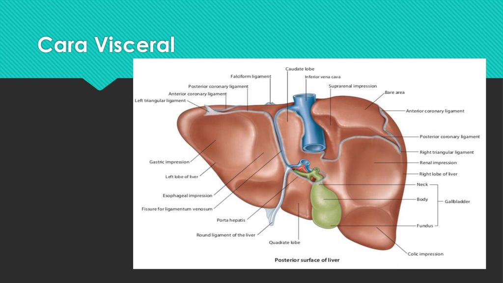Cara Visceral Se halla cubierta de peritoneo a exepcón de la fosa de la vesícula biliar y el porta hepatico.