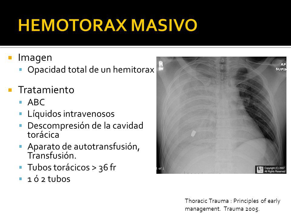 HEMOTORAX MASIVO Imagen Tratamiento Opacidad total de un hemitorax ABC