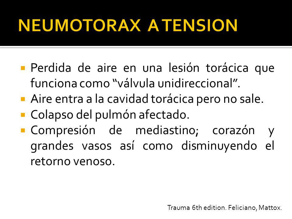 NEUMOTORAX A TENSION Perdida de aire en una lesión torácica que funciona como válvula unidireccional .