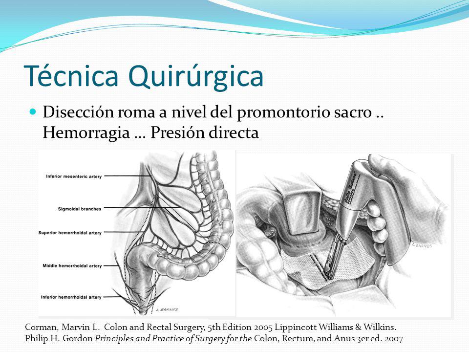Técnica Quirúrgica Disección roma a nivel del promontorio sacro .. Hemorragia … Presión directa.