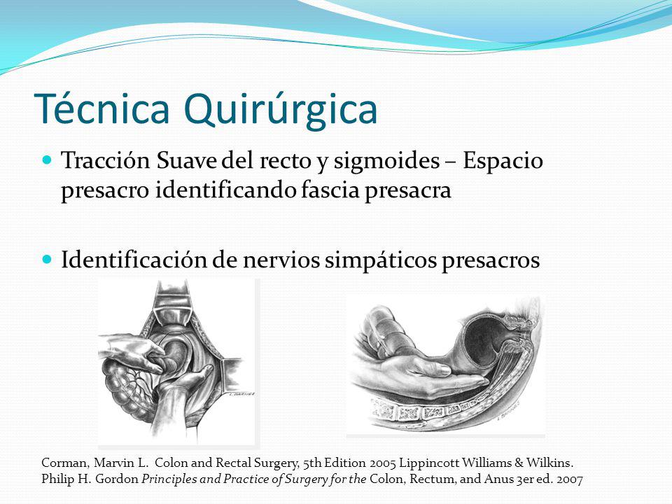 Técnica Quirúrgica Tracción Suave del recto y sigmoides – Espacio presacro identificando fascia presacra.
