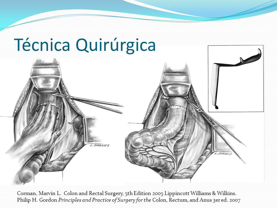 Técnica Quirúrgica Corman, Marvin L. Colon and Rectal Surgery, 5th Edition 2005 Lippincott Williams & Wilkins.