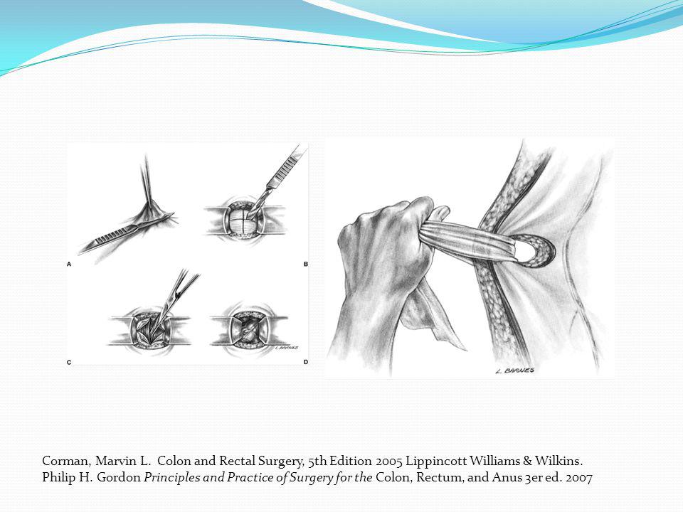Corman, Marvin L. Colon and Rectal Surgery, 5th Edition 2005 Lippincott Williams & Wilkins.