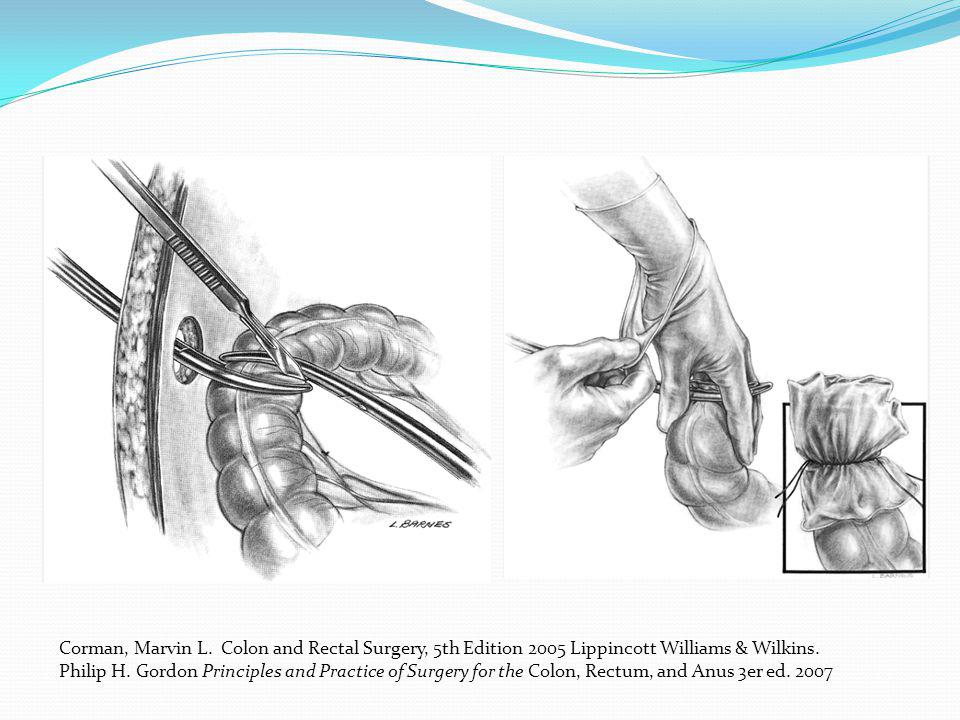 Corman, Marvin L. Colon and Rectal Surgery, 5th Edition 2005 Lippincott Williams & Wilkins.