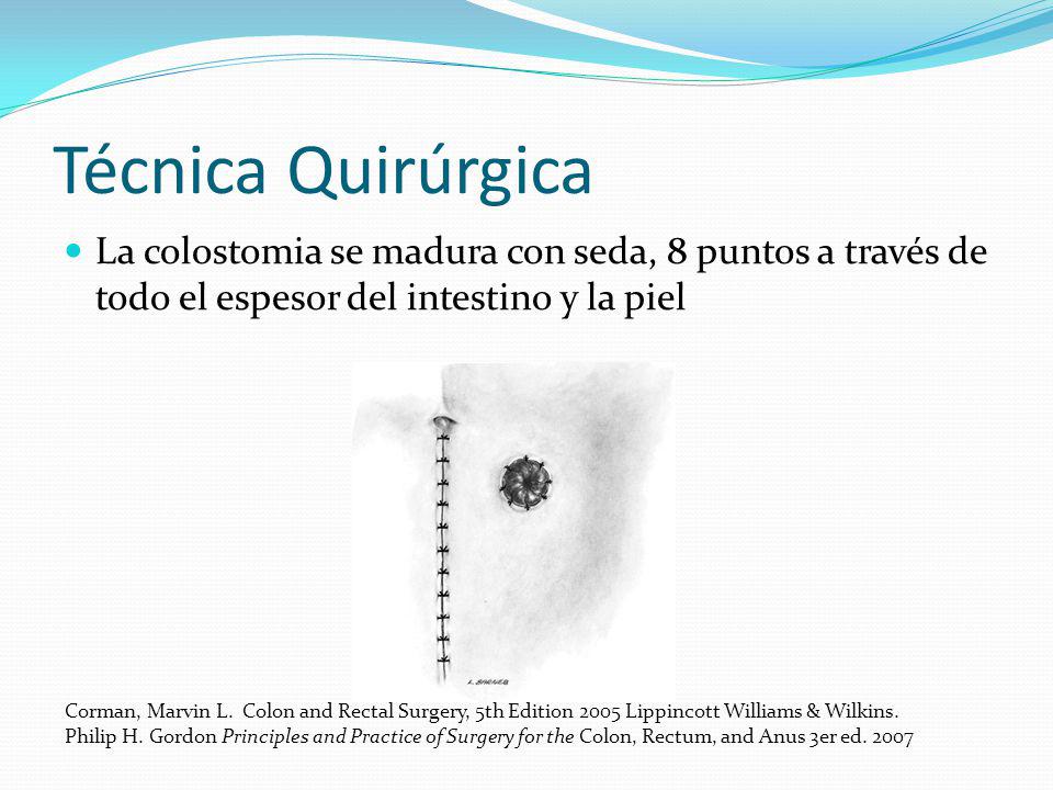 Técnica Quirúrgica La colostomia se madura con seda, 8 puntos a través de todo el espesor del intestino y la piel.