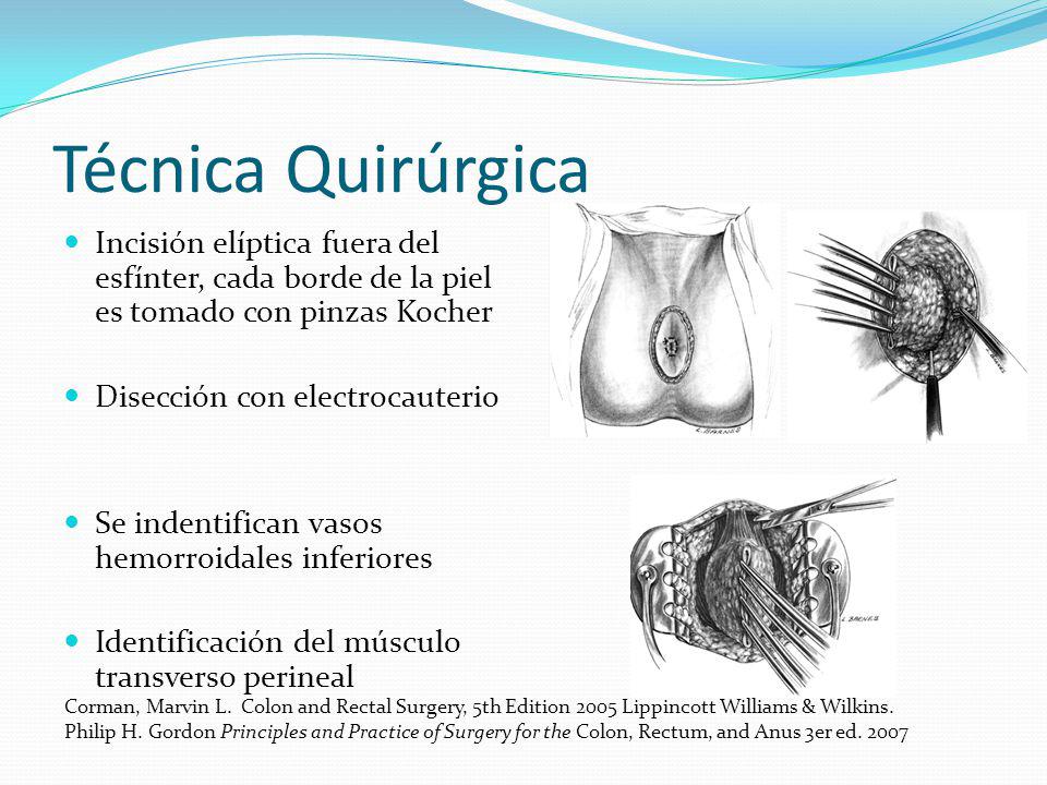 Técnica Quirúrgica Incisión elíptica fuera del esfínter, cada borde de la piel es tomado con pinzas Kocher.