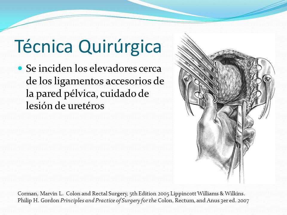 Técnica Quirúrgica Se inciden los elevadores cerca de los ligamentos accesorios de la pared pélvica, cuidado de lesión de uretéros.