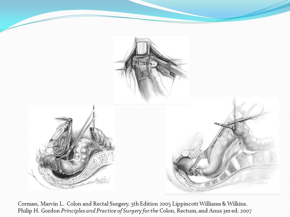 Corman, Marvin L. Colon and Rectal Surgery, 5th Edition 2005 Lippincott Williams & Wilkins.
