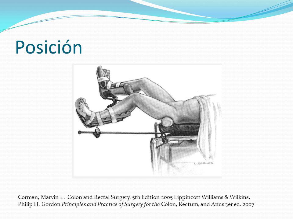 Posición Corman, Marvin L. Colon and Rectal Surgery, 5th Edition 2005 Lippincott Williams & Wilkins.