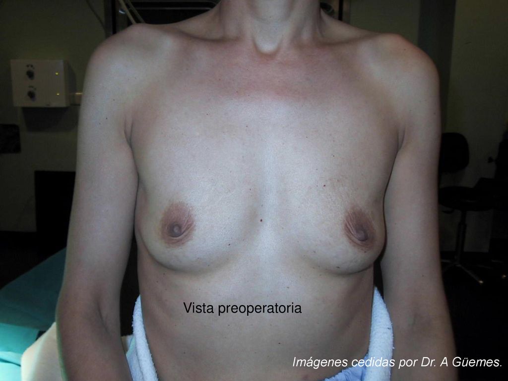 Vista preoperatoria Imágenes cedidas por Dr. A Güemes.