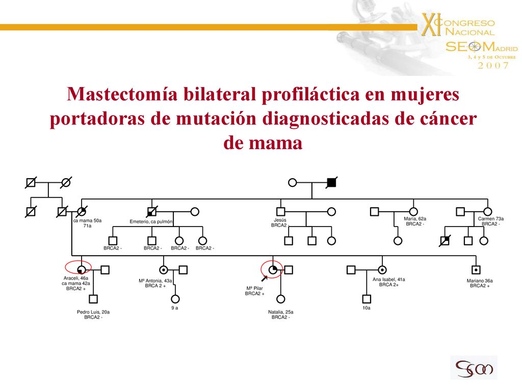 Mastectomía bilateral profiláctica en mujeres portadoras de mutación diagnosticadas de cáncer de mama