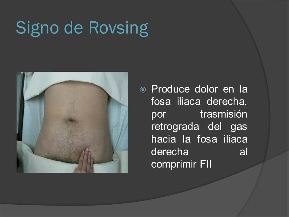 Signo de Rovsing Produce dolor en la fosa iliaca derecha, por trasmisión retrograda del gas hacia la fosa iliaca derecha al comprimir FII.