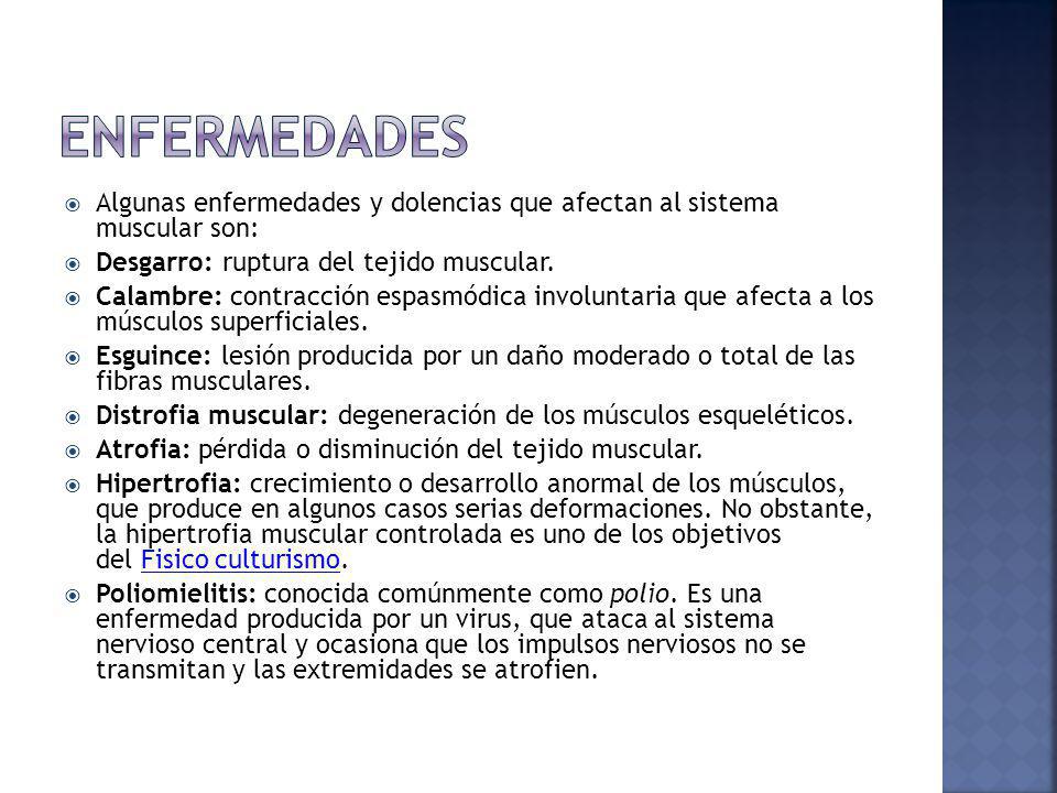 ENFERMEDADES Algunas enfermedades y dolencias que afectan al sistema muscular son: Desgarro: ruptura del tejido muscular.