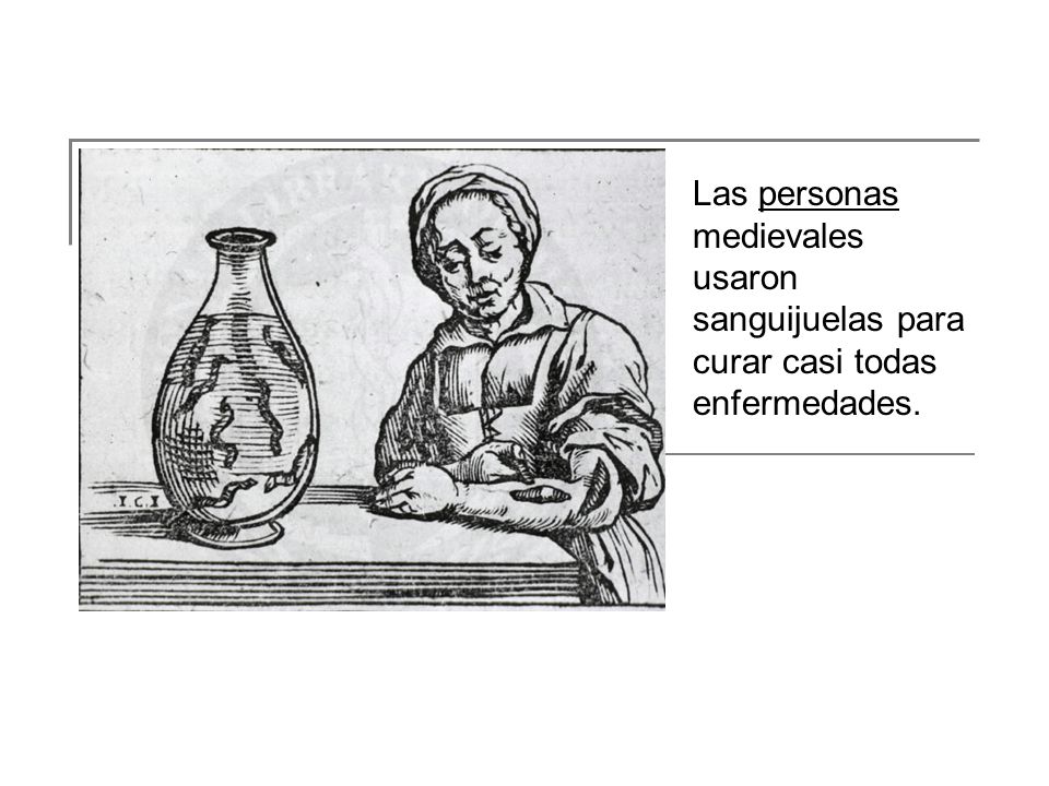 Las personas medievales usaron sanguijuelas para curar casi todas enfermedades.