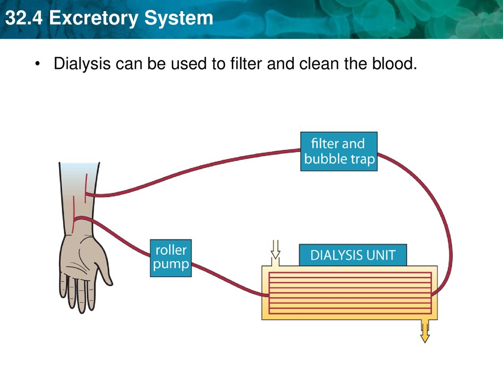 Dialysis can be used to filter and clean the blood.