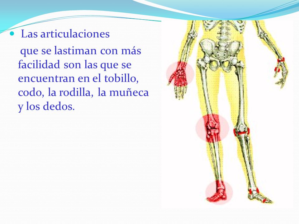 Las articulaciones que se lastiman con más facilidad son las que se encuentran en el tobillo, codo, la rodilla, la muñeca y los dedos.