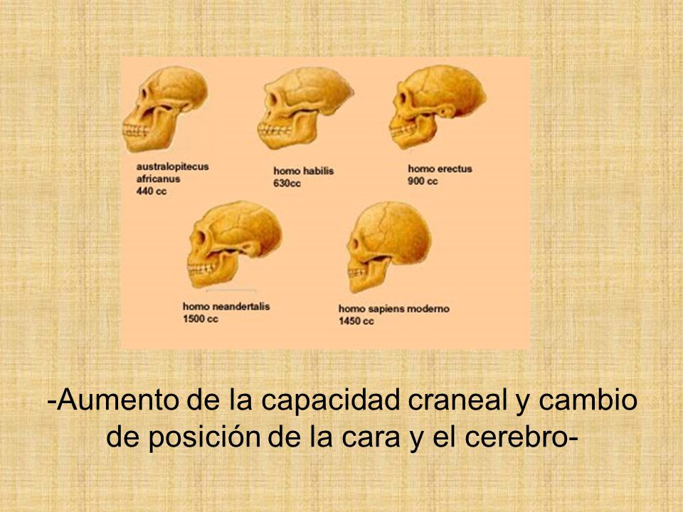 -Aumento de la capacidad craneal y cambio de posición de la cara y el cerebro-