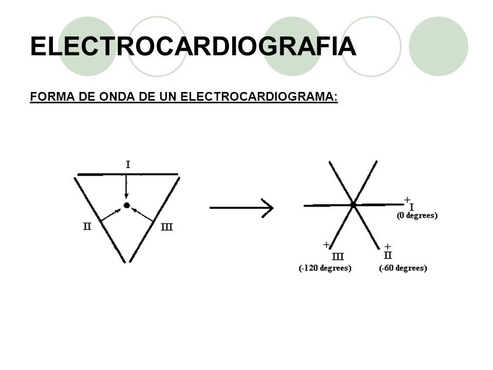 ELECTROCARDIOGRAFIA FORMA DE ONDA DE UN ELECTROCARDIOGRAMA: