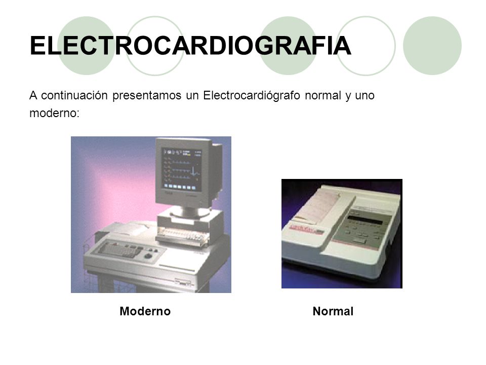 ELECTROCARDIOGRAFIA A continuación presentamos un Electrocardiógrafo normal y uno. moderno: Moderno.