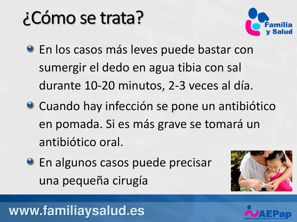 ¿Cómo se trata En los casos más leves puede bastar con sumergir el dedo en agua tibia con sal durante minutos, 2-3 veces al día.