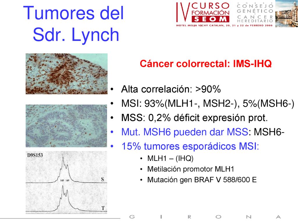 Tumores del Sdr. Lynch Cáncer colorrectal: IMS-IHQ