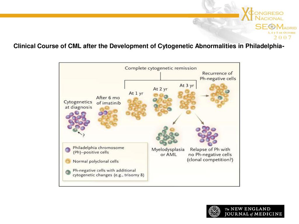 Clinical Course of CML after the Development of Cytogenetic Abnormalities in Philadelphia-Chromosome–Negative Cells