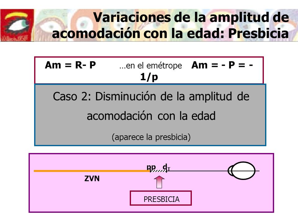 Variaciones de la amplitud de acomodación con la edad: Presbicia