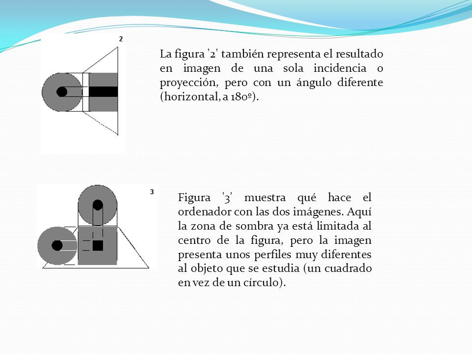 La figura 2 también representa el resultado en imagen de una sola incidencia o proyección, pero con un ángulo diferente (horizontal, a 180º).