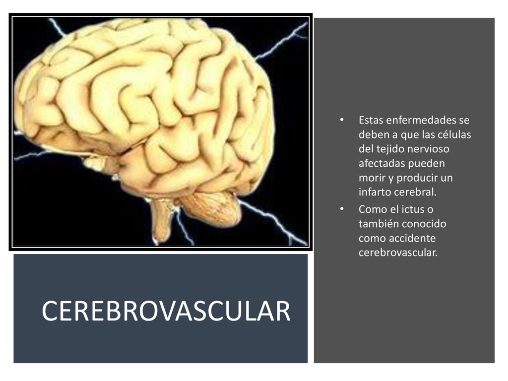 Estas enfermedades se deben a que las células del tejido nervioso afectadas pueden morir y producir un infarto cerebral.