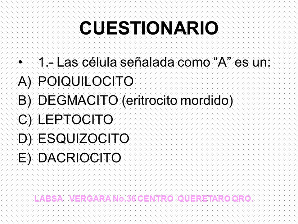 CUESTIONARIO 1.- Las célula señalada como A es un: POIQUILOCITO
