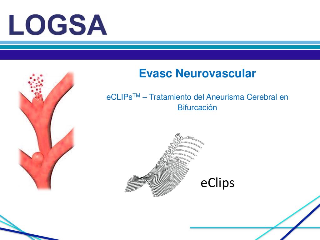 Evasc Neurovascular eCLIPsTM – Tratamiento del Aneurisma Cerebral en Bifurcación