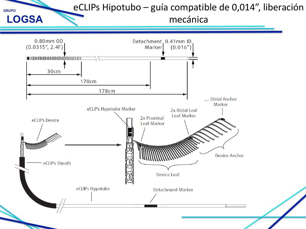 eCLIPs Hipotubo – guía compatible de 0,014 , liberación mecánica