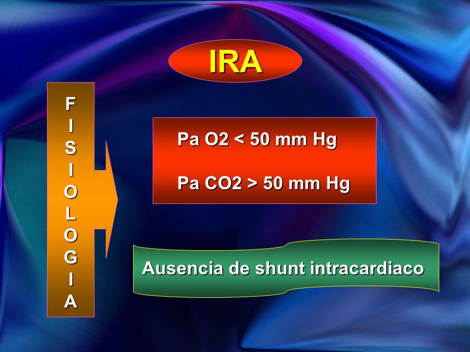 IRA F I S Pa O2 < 50 mm Hg O L Pa CO2 > 50 mm Hg G A