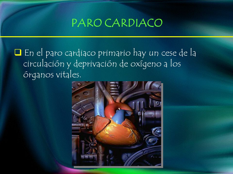 PARO CARDIACO En el paro cardiaco primario hay un cese de la
