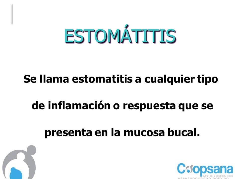 ESTOMÁTITIS Se llama estomatitis a cualquier tipo de inflamación o respuesta que se presenta en la mucosa bucal.